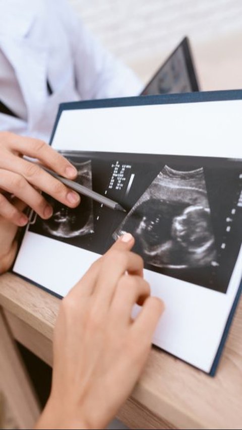 USG Kehamilan Crown Rump Length, Lebih Akurat Prediksi Tanggal Persalinan