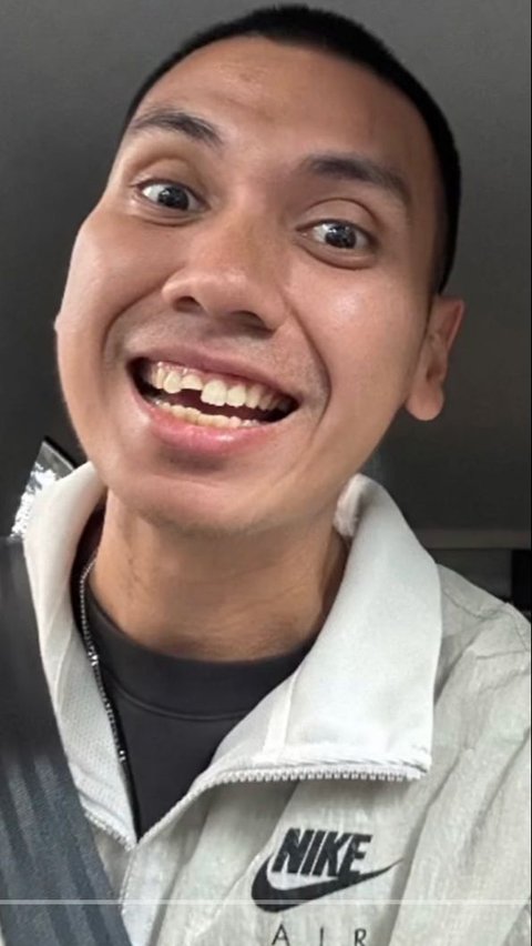 Rayi RAN Curhat Giginya Patah Saat Makan, Netizen: Masih Ketolong Sama Wajah Tampan