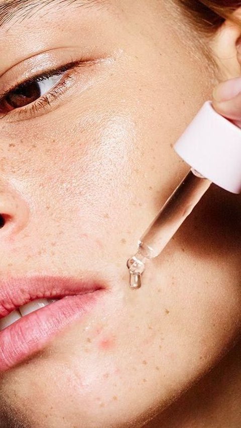 Can I Use Serum When My Face Has Acne? Here's How to Choose the Right Skincare