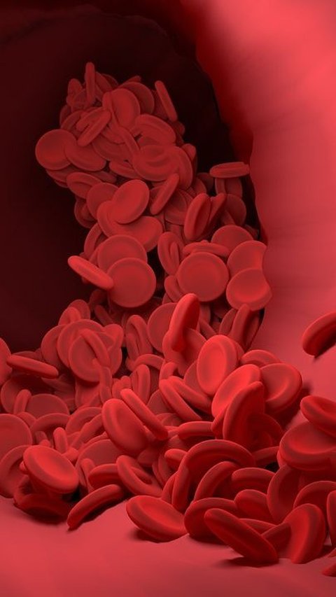 Cara Meningkatkan HB dengan Cepat, Transfusi Darah hingga Konsumsi Makanan Kaya Folat