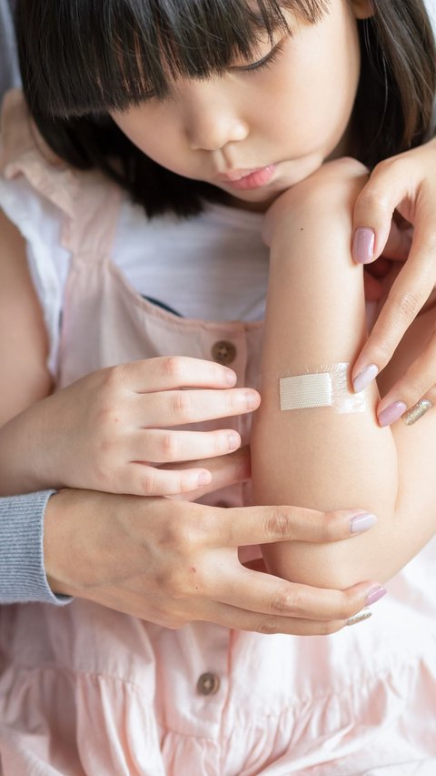 Don't Use Band-Aids Immediately, Here's the Right Way to Treat Wounds
