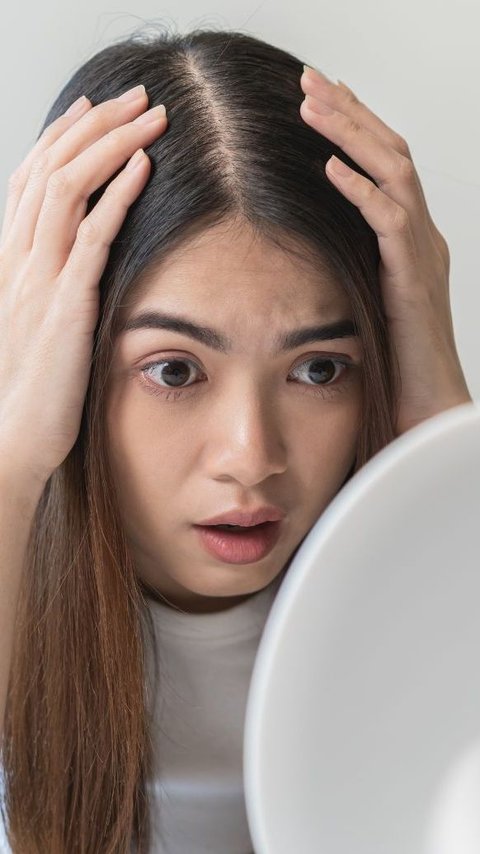 Rambut Lepek dan Berminyak Disebabkan Oleh Kebiasaan Ini, Hentikan Sekarang Juga!