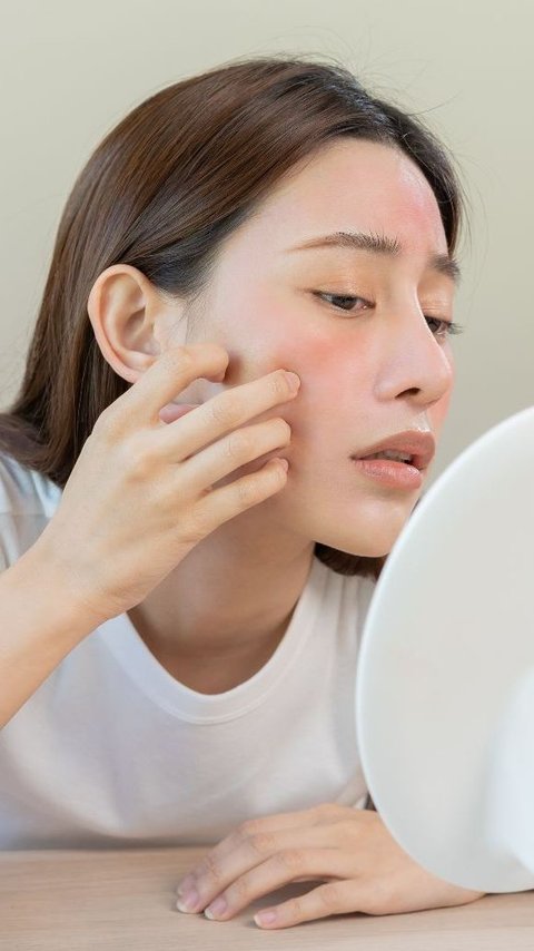 Myth or Fact? Acne on the Left Cheek is Believed to be a Sign of Longing
