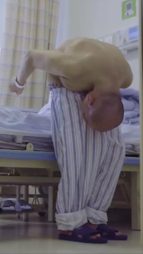 Touching Story of the Folded Human, His Body Stands Tall Again After Being Bent for 28 Years