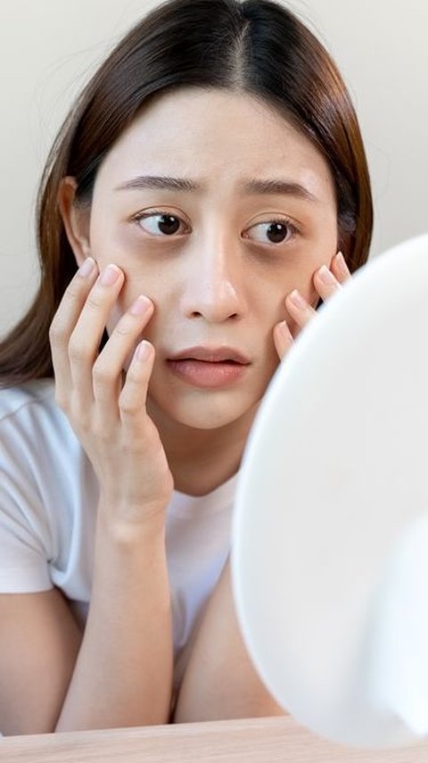 Deficiency of These 5 Vitamins Can Actually Cause Dark Circles Around the Eyes, Check Your Condition!