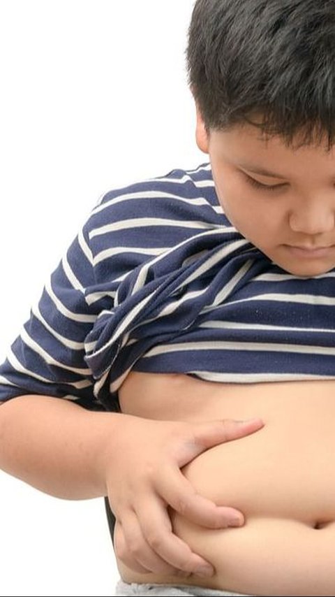 Bahaya Obesitas pada Anak yang Perlu Diwaspadai, Begini Cara Mengatasinya