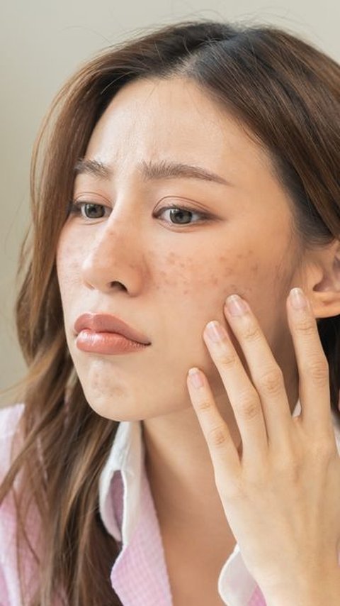 2 Methods to Overcome Skin Spots Due to Sun Exposure