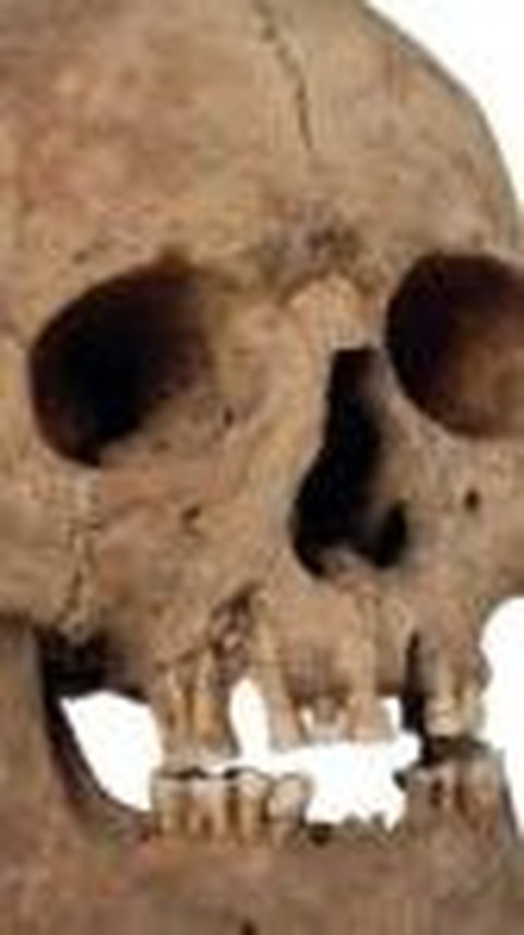 Arkeolog Temukan Tiga Tengkorak Bangsa Viking Berbentuk Lonjong dan Gigi Dikikir, Alasannya Ternyata Unik