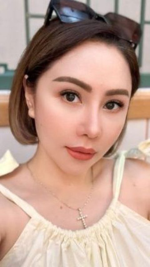 9 Transformasi Artis Sebelum dan Sesudah Filler Dagu, Wajah Makin Tirus Bikin Pangling