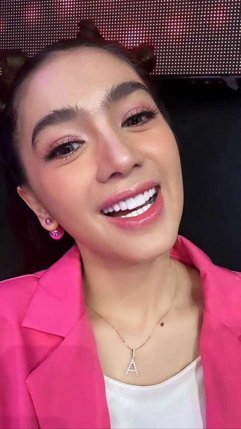 Angel Karamoy Pamer Hasil Operasi Plastiknya Setelah Tiga Bulan, Senyumnya Lebih Alami Meskipun Masih Sulit Tertawa