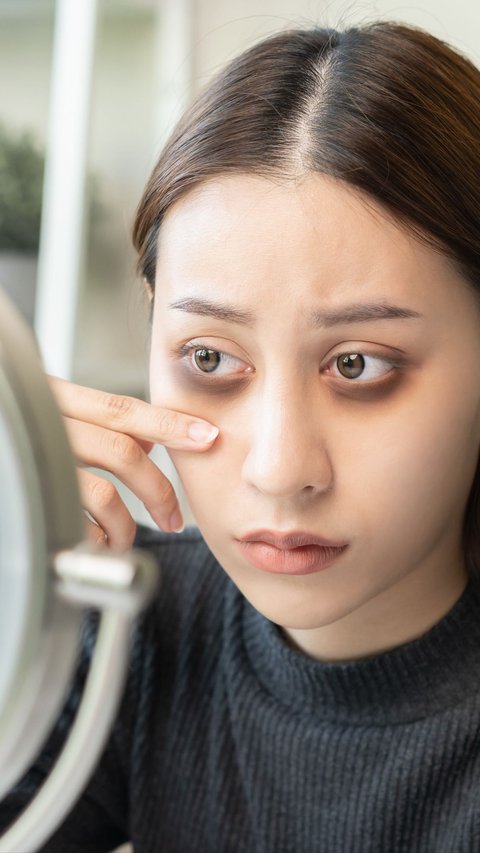 Not Just Lack of Sleep, Excessive Caffeine Consumption Makes Eye Bags Worse