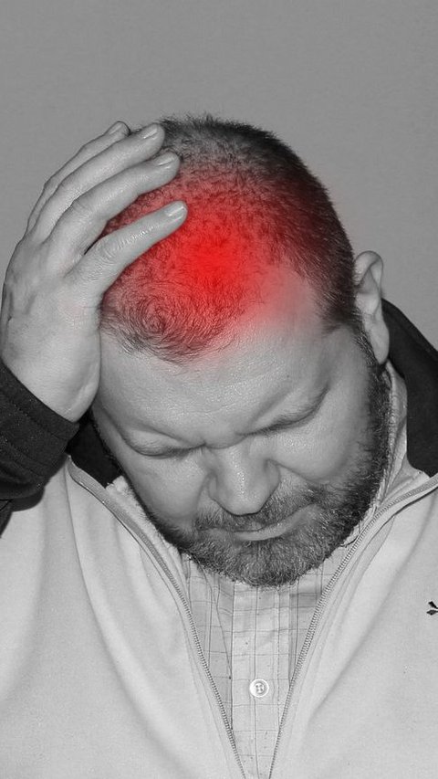 8 Penyebab Sakit Kepala Berdenyut, Migrain hingga Efek Minum Alkohol Berlebihan