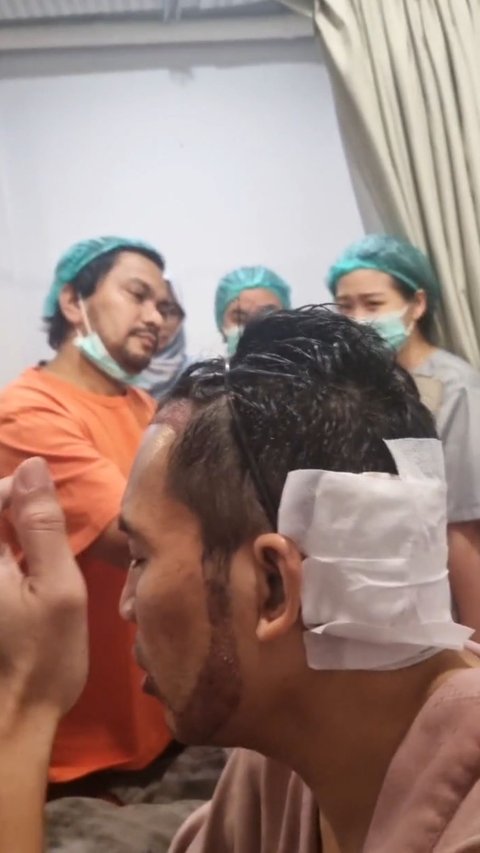 Segini Biaya yang Dikeluarkan Desta untuk Transplantasi Rambut di Klinik Tompi