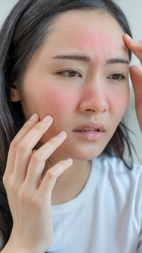 2 Important Treatments When Skin Peels, Don't Let It Get Worse