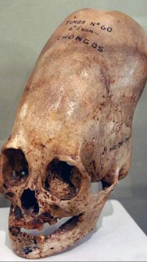 The Mystery of the Discovery of Elongated Skulls in Peru Solved, They Are Not Aliens