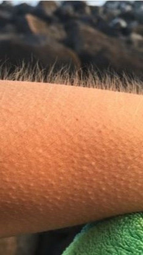 Reasons Why Someone Feeling Goosebumps: Could it Be Because of Supernatural Beings?