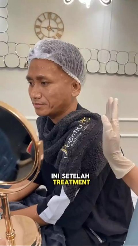 9 Photos of Pegi Setiawan Getting More 'Glowing' After Becoming a TikTok Celebrity, Regular Treatments at a Beauty Clinic