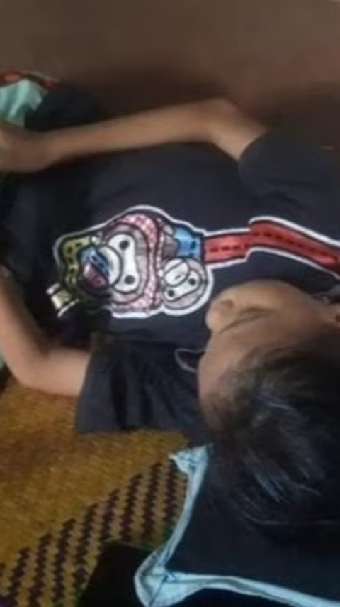 Miris, Remaja Putri di Ogan Ilir Terpaksa Putus Sekolah dan Tak Bisa Berobat Akibat Gizi Buruk