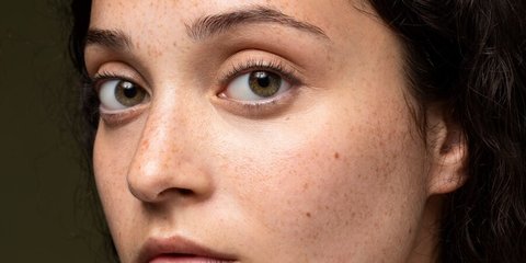 Cara Mengatasi Flek Hitam di Wajah dengan AHA Alami, Tak Perlu Beli Serum