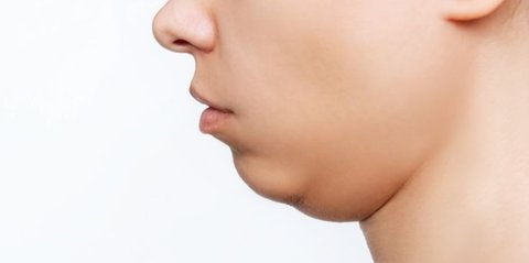 Bikin Wajah Lebih Tirus! Ini 6 Cara Alami Hilangkan Double Chin Tanpa Ribet