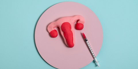 Jerawat Muncul Setelah Pasang IUD? Simak Penjelasan Ahli