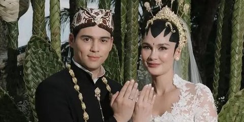 7 Alasan Mengapa Kita Suka Ikut Campur dan Penasaran Kehidupan Artis, dari Hiburan Sampai Mencari Pelarian