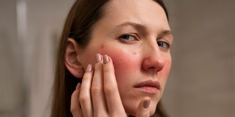 Kulit Kering dan Dehidrasi Itu Beda, Ini Penjelasan Lengkap Ahli Dermatologi