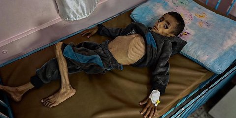 'Sejauh Mata Memandang, Anda Melihat Orang-Orang Kurus Kering Kelaparan'