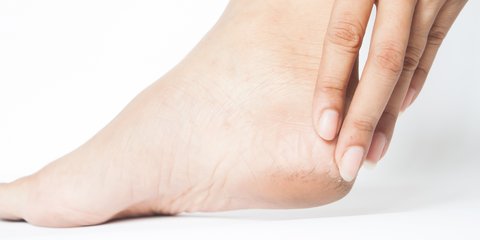 Cara Aman Atasi Kulit Kaki Mengelupas, Hindari Langkah Berbahaya Ini yang Bikin Kaki Infeksi
