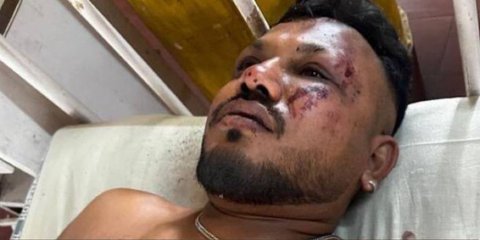 Keajaiban di Kursi 11A: Kisah Satu-satunya Penumpang Selamat karena Melompat dari Pesawat Air India