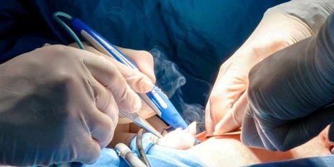 Apa Itu Parafimosis? Komplikasi dan Cara Mengatasi, Sunat Bisa Jadi Solusi?