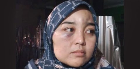 Viral Istri di Garut Diduga Dianiaya Suami hingga Luka Parah karena Dituduh Selingkuh