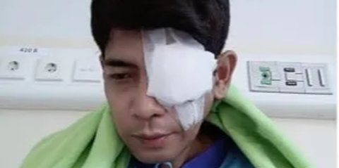 Lama Tak Terdengar Kabarnya, Begini Kondisi Veri AFI Usai Jalani Operasi Mata Kiri