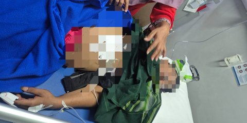 Bermula dari Telepon Misterius, Pemuda lagi Nongkrong Tiba-Tiba Didatangi Sekumpulan Pemotor lalu Ditikam
