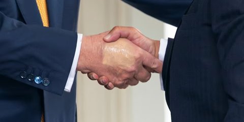 VIDEO: Tangan dan Kaki Bengkak, Kondisi Terkini Kesehatan Presiden AS Trump dari Gedung Putih