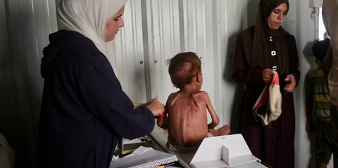 FOTO: Di Tengah Aturan Baru Israel, Warga Gaza Antre Perawatan di Posko Medis LSM Lokal