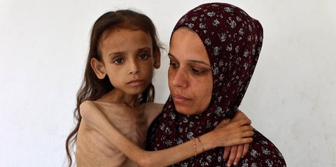 FOTO: Potret Pedih Mariam Anak 9 Tahun, Korban Kelaparan Gaza