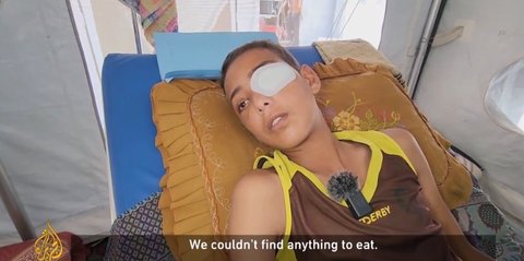 Tentara Israel Makin Gila, Tembak Mata Remaja Palestina di Gaza yang Kelaparan
