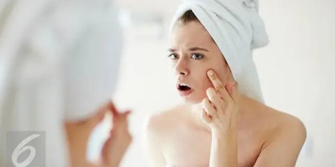 Zinc Banyak Dibicarakan di Media Sosial Untuk Obat Jerawat, Apakah Benar Efektif?