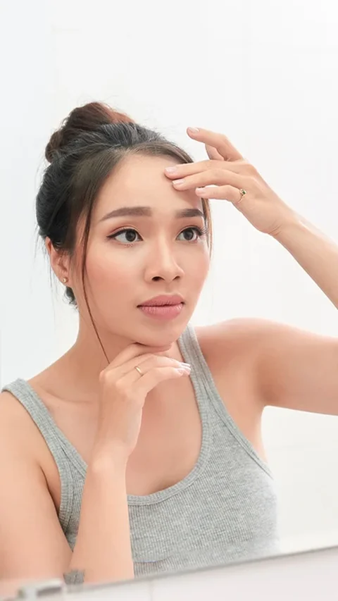 Mirip tapi Tak Sama, Kenali Perbedaan PIE vs PIH Agar Bekas Jerawat Cepat Memudar