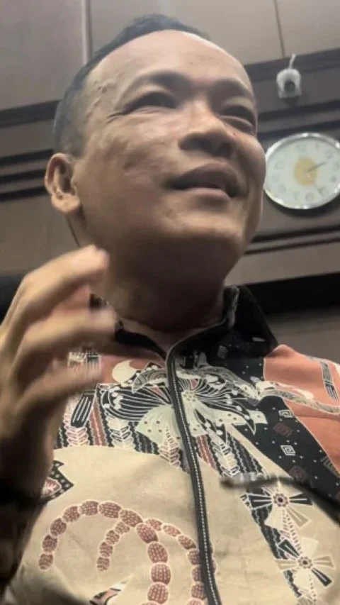 Wajah Immanuel 'Noel' Ebenezer Bengkak karena Sakit Gigi: Kaya Digebukin Tahanan