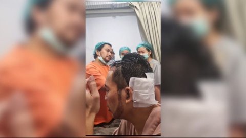 Segini Biaya yang Dikeluarkan Desta untuk Transplantasi Rambut di Klinik Tompi