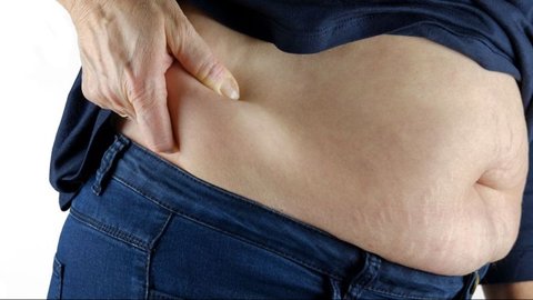 Tips Cegah Kulit Kendur saat Berat Badan Turun Drastis