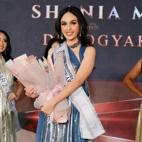 Dedikasi dan Kepedulian, Shania Binti Mahir Hamdun Model Cantik Aktif Kegiatan Sosial