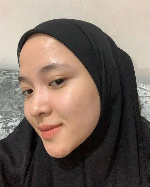 Potret Nissa Sabyan Percaya Diri Tampilkan Wajah Berjerawat Tanpa Makeup, Bikin Pangling