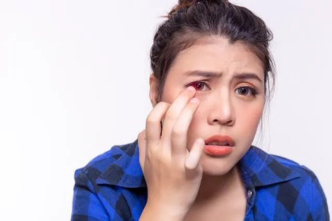 Jangan Dianggap Sepele, Ternyata Sakit di Mata Bisa Jadi Gejala Stroke