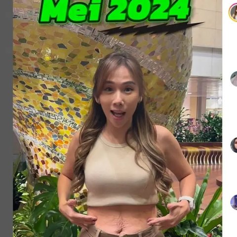 Potret Cherly Juno Eks CherryBelle Pamer Perut Rata Usai Operasi Plastik Tummy Tuck di Korea