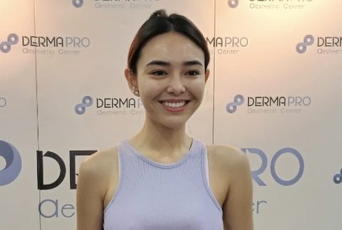 Amanda Manopo Pilih Perawatan Alami dan Hindari Operasi Plastik untuk Jaga Penampilannya Tetap Cantik