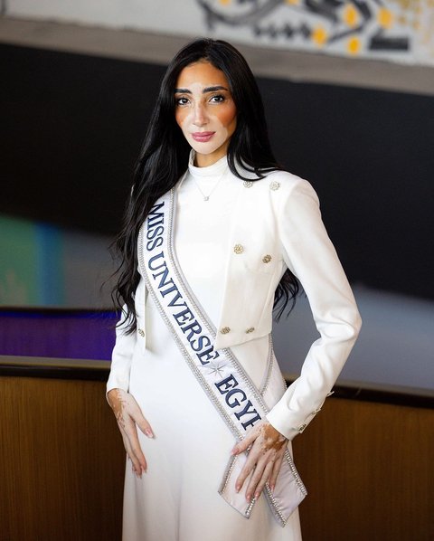 Intip Profil Menarik Logina Salah, Peserta Miss Universe Pertama yang Mengidap Vitiligo