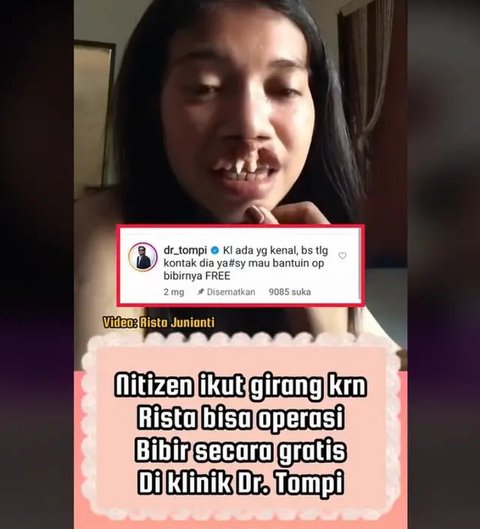 Video Suara Merdu Rista Junianti Wanita Berbibir Sumbing Viral di Media Sosial, Komentar Tompi Jadi Sorotan Netizen